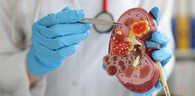foods to avoid with kidney disease and diabetes